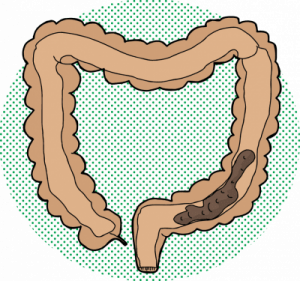 Gut Restore Gut Restore