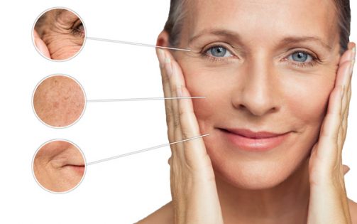 Perché ha senso apportare il collagene naturale