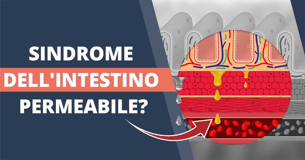 Sindrome dell’intestino permeabile