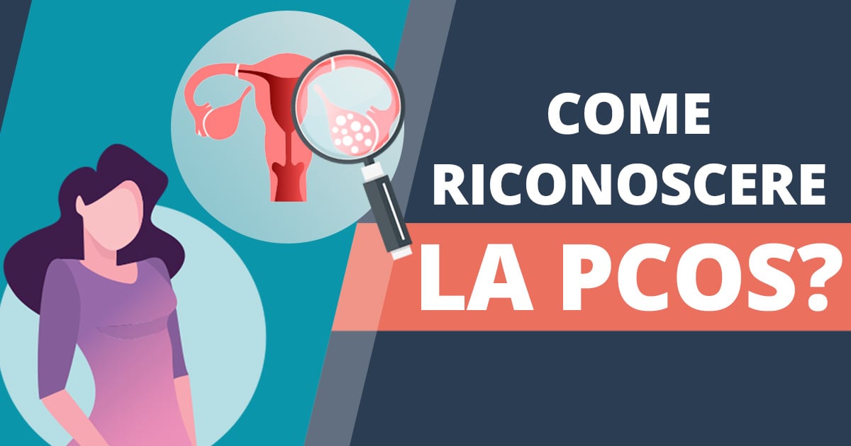 Sindrome dell’ovaio policistico (PCOS) – disturbo ormonale più frequente nelle donne